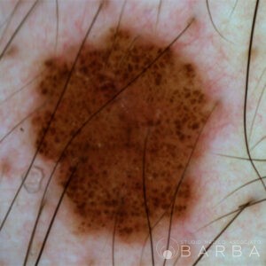 nevo_01